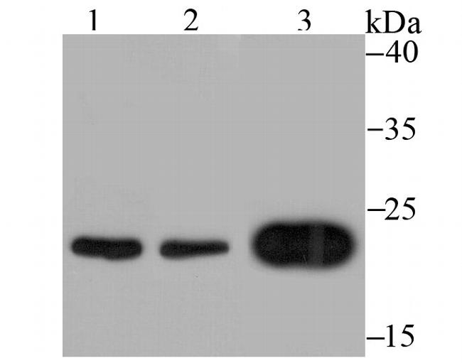 MAD2 Antibody in Western Blot (WB)