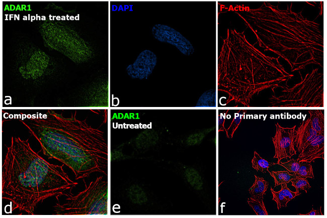 ADAR1 Antibody in Immunocytochemistry (ICC/IF)