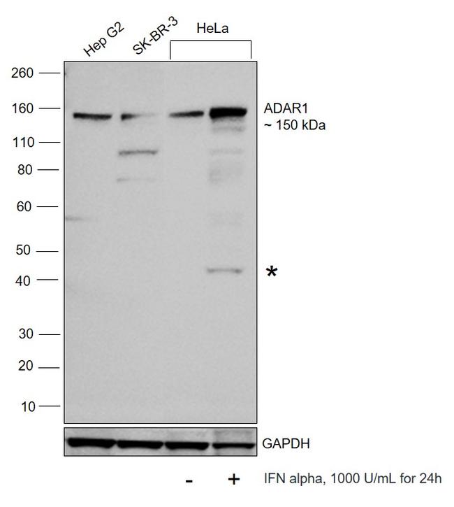 ADAR1 Antibody in Western Blot (WB)