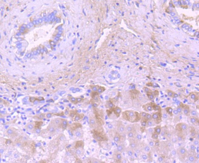 Complement C3 Antibody in Immunohistochemistry (Paraffin) (IHC (P))