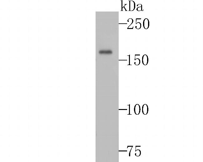 Complement C3 Antibody in Western Blot (WB)