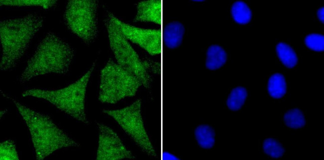 NR0B1 Antibody in Immunocytochemistry (ICC/IF)