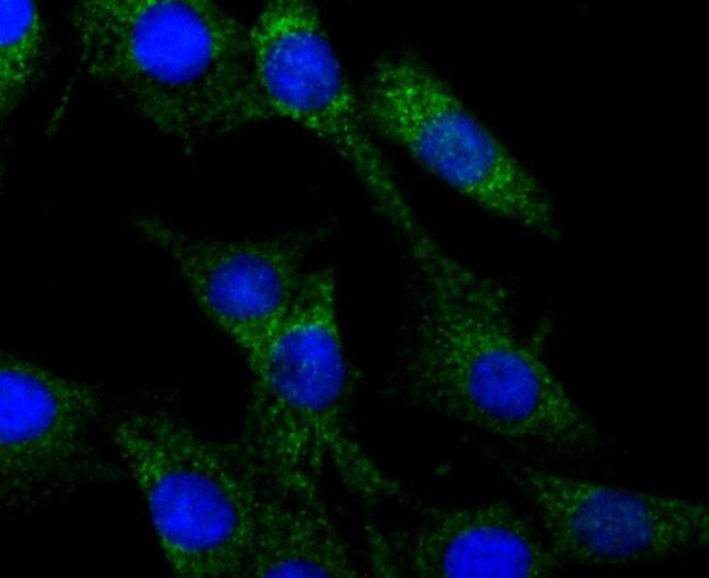 CRMP1 Antibody in Immunocytochemistry (ICC/IF)