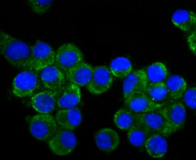 CRMP1 Antibody in Immunocytochemistry (ICC/IF)