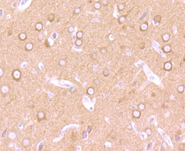 CRMP1 Antibody in Immunohistochemistry (Paraffin) (IHC (P))