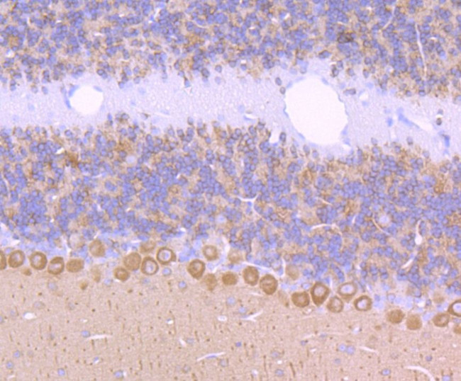 CRMP1 Antibody in Immunohistochemistry (Paraffin) (IHC (P))