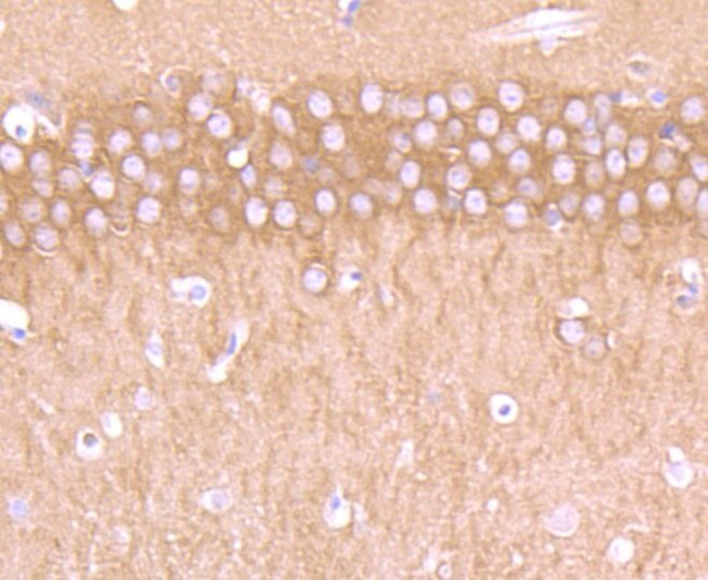 CRMP1 Antibody in Immunohistochemistry (Paraffin) (IHC (P))