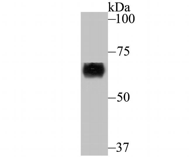 CRMP1 Antibody in Western Blot (WB)