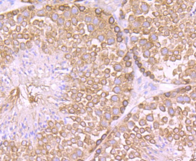 CAS Antibody in Immunohistochemistry (Paraffin) (IHC (P))