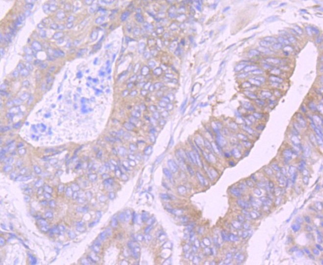 CAS Antibody in Immunohistochemistry (Paraffin) (IHC (P))