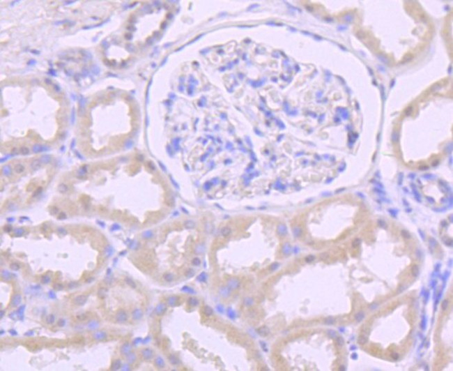 DKC1 Antibody in Immunohistochemistry (Paraffin) (IHC (P))