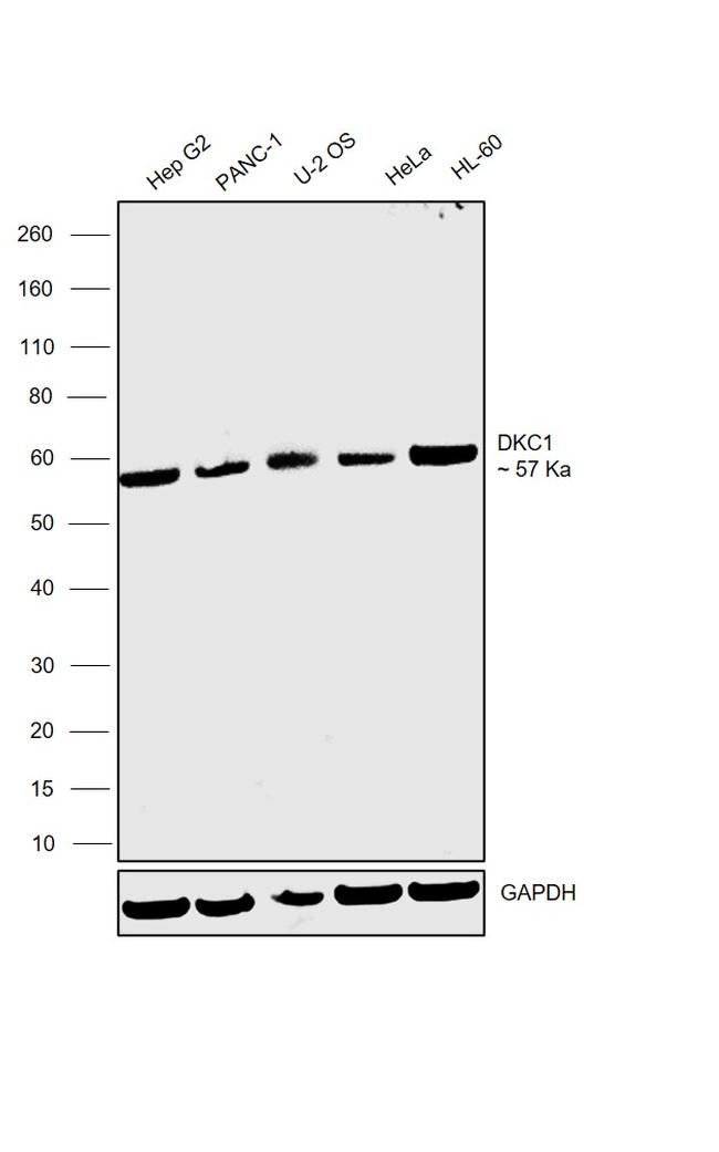 DKC1 Antibody in Western Blot (WB)