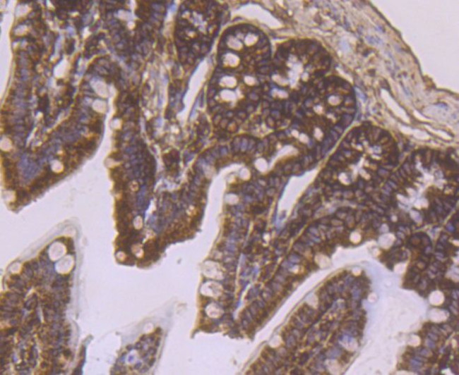 RPS19 Antibody in Immunohistochemistry (Paraffin) (IHC (P))