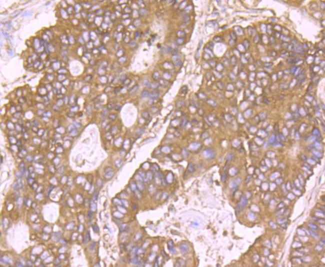 RPS19 Antibody in Immunohistochemistry (Paraffin) (IHC (P))