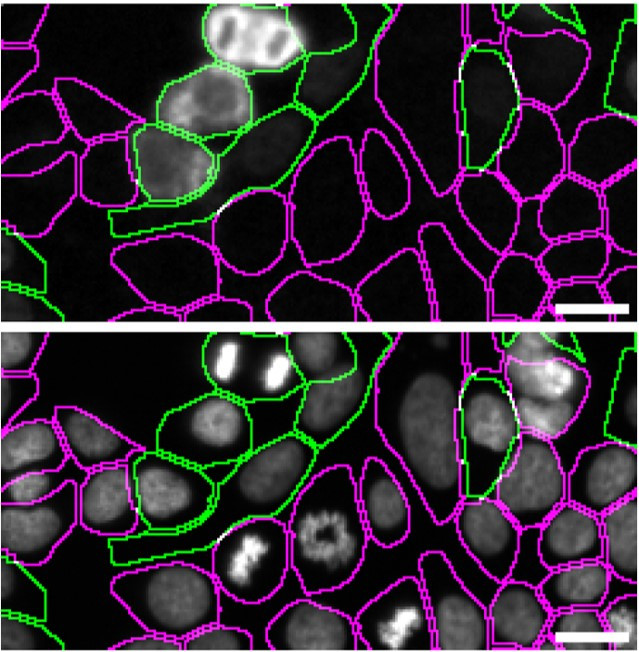 MATR3 Antibody in Immunocytochemistry (ICC/IF)