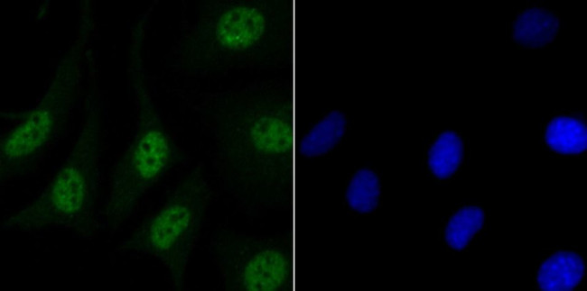 MATR3 Antibody in Immunocytochemistry (ICC/IF)