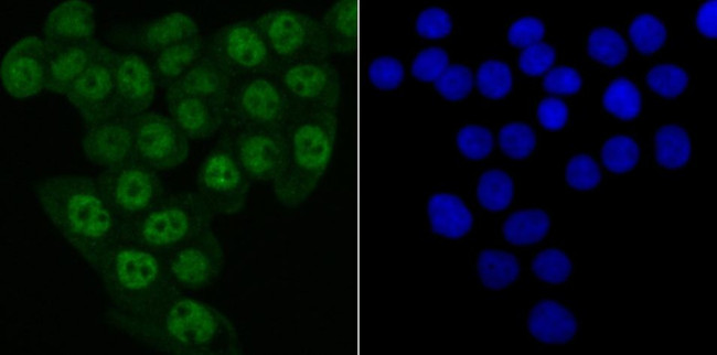 MATR3 Antibody in Immunocytochemistry (ICC/IF)