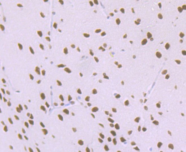 MATR3 Antibody in Immunohistochemistry (Paraffin) (IHC (P))