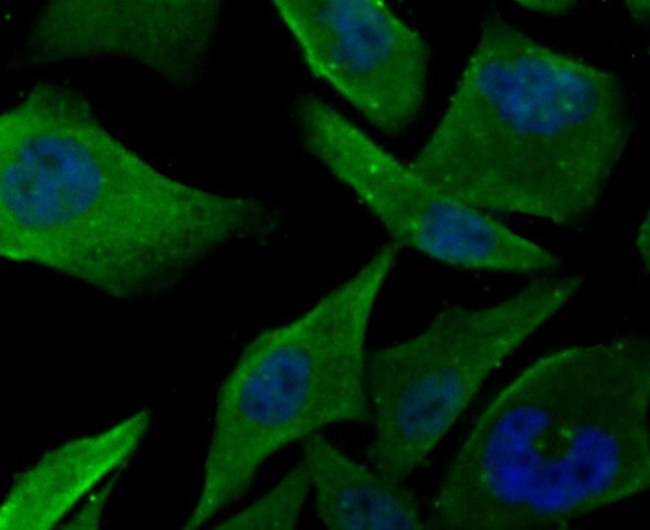 PFKM Antibody in Immunocytochemistry (ICC/IF)