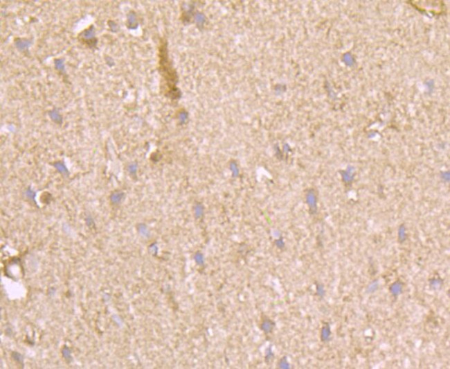 PFKM Antibody in Immunohistochemistry (Paraffin) (IHC (P))