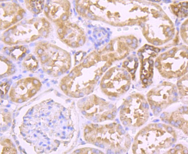 PFKM Antibody in Immunohistochemistry (Paraffin) (IHC (P))