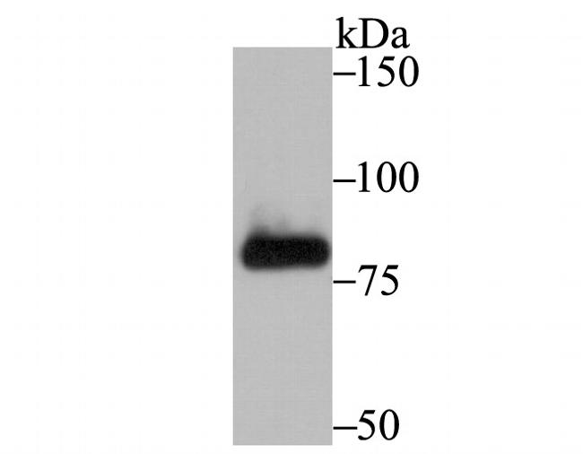 PFKM Antibody in Western Blot (WB)