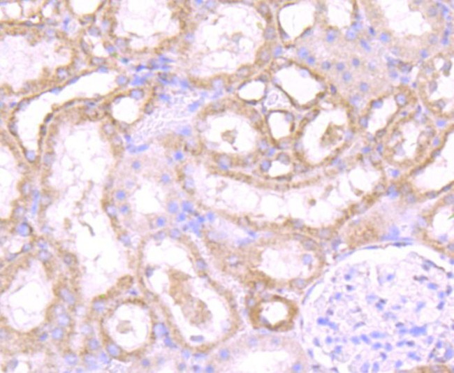 PSME1 Antibody in Immunohistochemistry (Paraffin) (IHC (P))