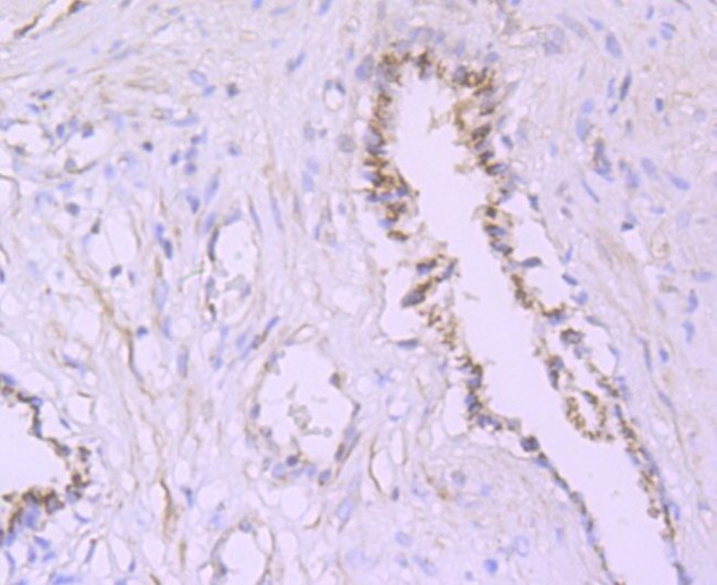 PSME1 Antibody in Immunohistochemistry (Paraffin) (IHC (P))