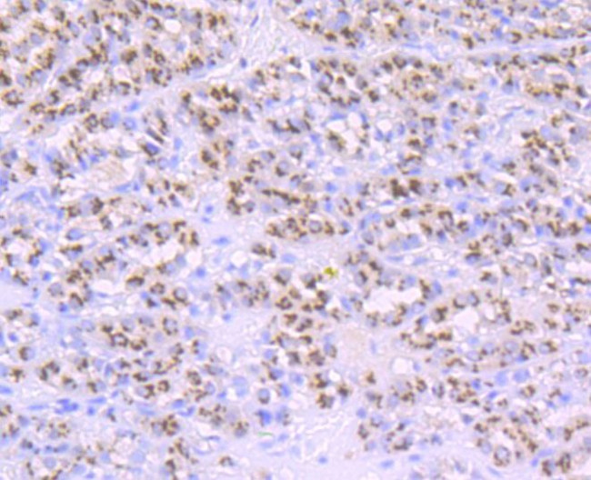 PSME1 Antibody in Immunohistochemistry (Paraffin) (IHC (P))