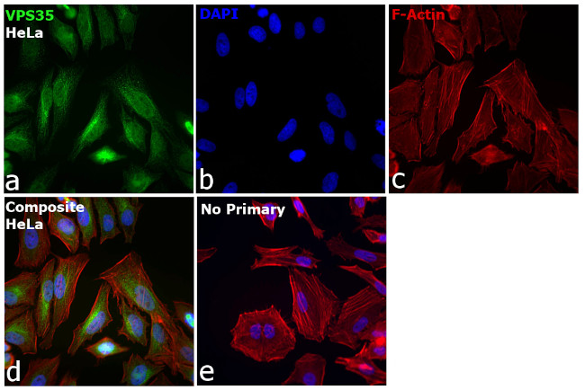 VPS35 Antibody in Immunocytochemistry (ICC/IF)