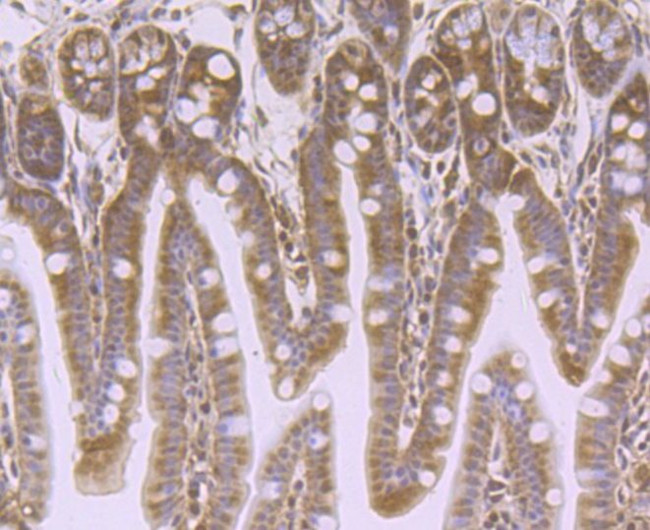 VPS35 Antibody in Immunohistochemistry (Paraffin) (IHC (P))