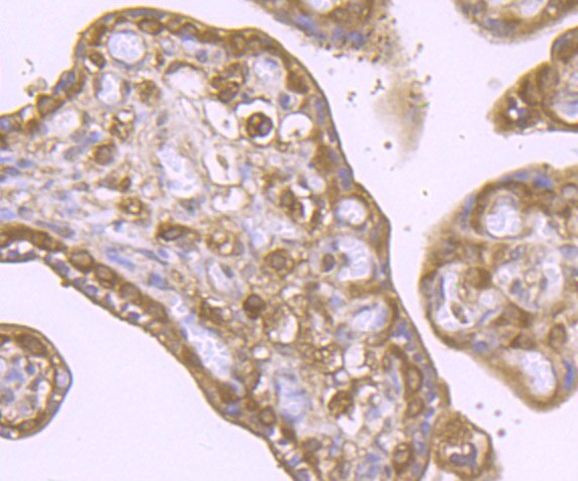 VPS35 Antibody in Immunohistochemistry (Paraffin) (IHC (P))