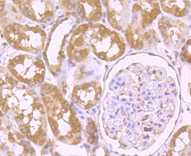 VPS35 Antibody in Immunohistochemistry (Paraffin) (IHC (P))