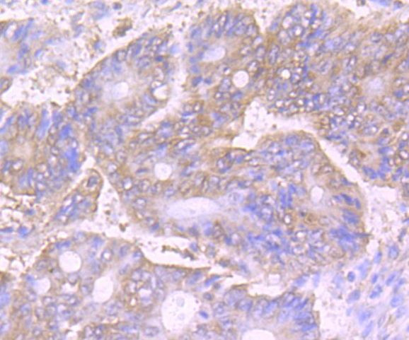 VPS35 Antibody in Immunohistochemistry (Paraffin) (IHC (P))