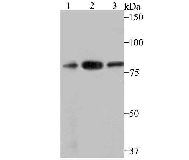 VPS35 Antibody in Western Blot (WB)