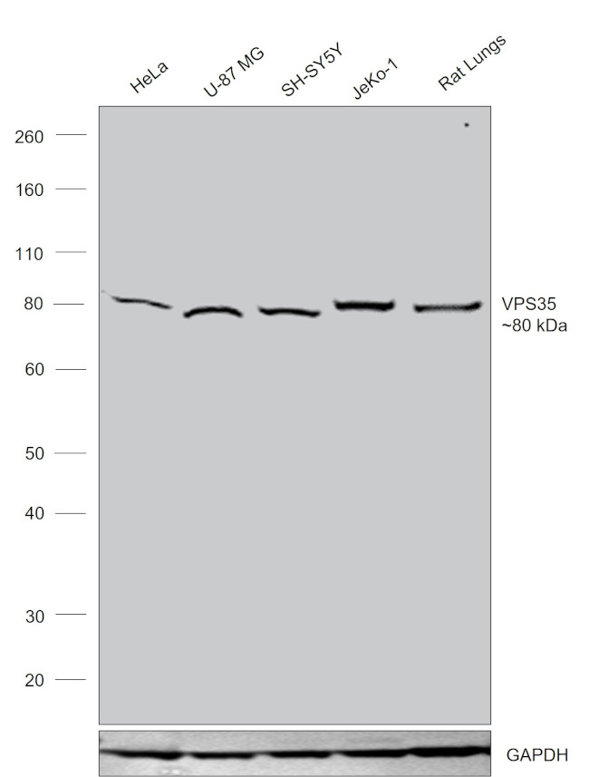 VPS35 Antibody in Western Blot (WB)