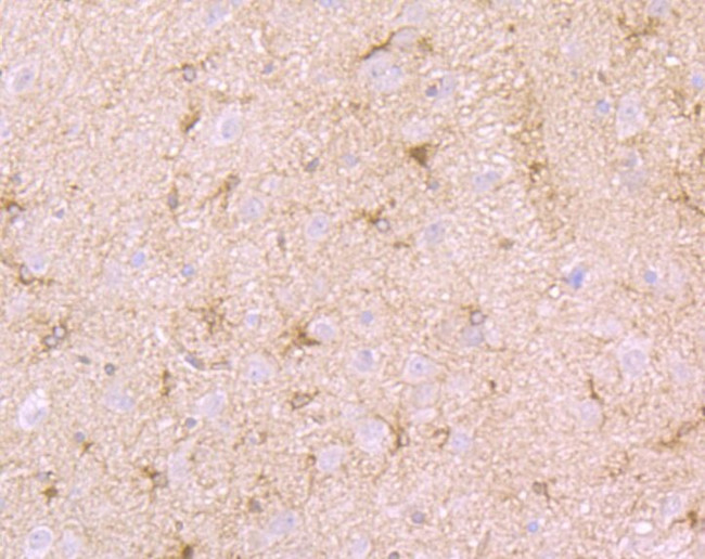 SEPT2 Antibody in Immunohistochemistry (Paraffin) (IHC (P))