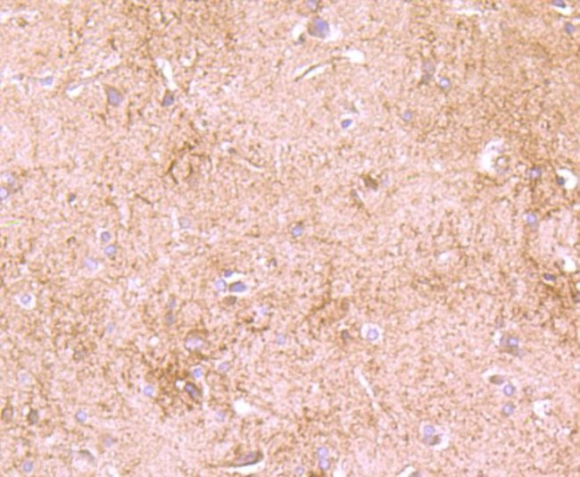 DDX6 Antibody in Immunohistochemistry (Paraffin) (IHC (P))