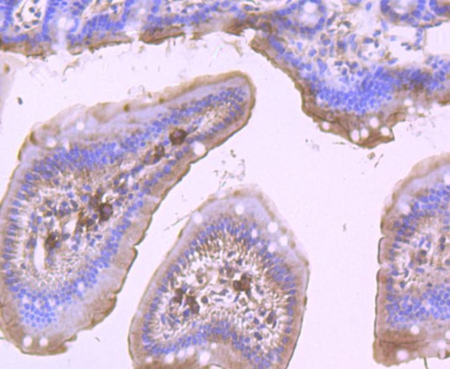 DDX6 Antibody in Immunohistochemistry (Paraffin) (IHC (P))