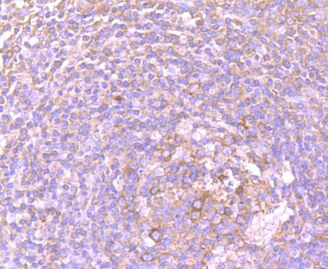 DDX6 Antibody in Immunohistochemistry (Paraffin) (IHC (P))