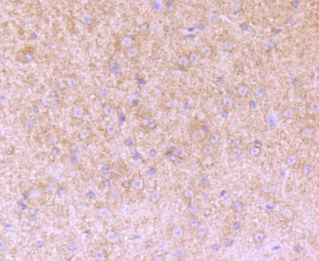 Versican Antibody in Immunohistochemistry (Paraffin) (IHC (P))