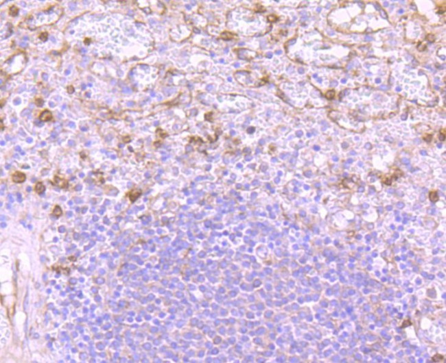 Versican Antibody in Immunohistochemistry (Paraffin) (IHC (P))