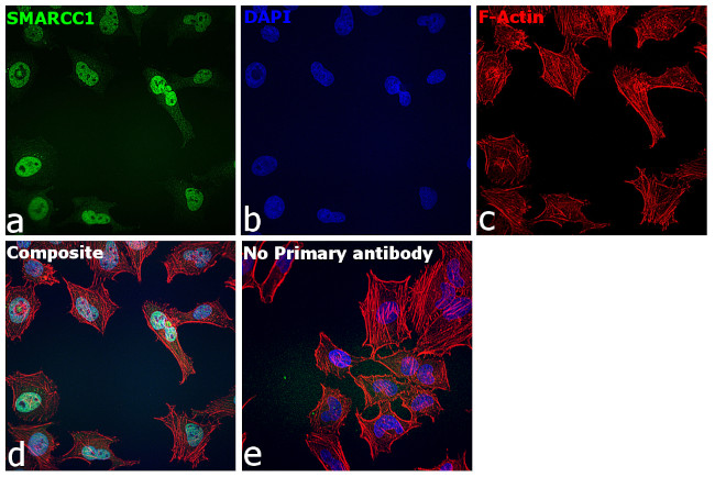 SMARCC1 Antibody in Immunocytochemistry (ICC/IF)