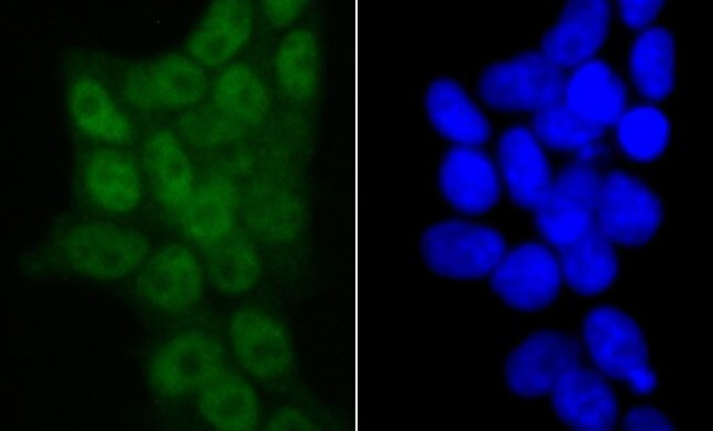 SMARCC1 Antibody in Immunocytochemistry (ICC/IF)