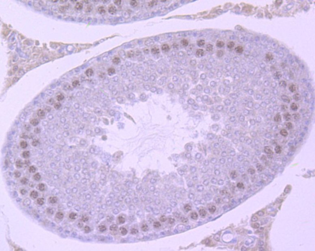 SMARCC1 Antibody in Immunohistochemistry (Paraffin) (IHC (P))