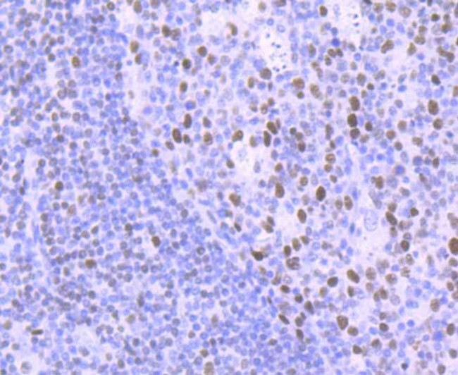 DNA Ligase I Antibody in Immunohistochemistry (Paraffin) (IHC (P))