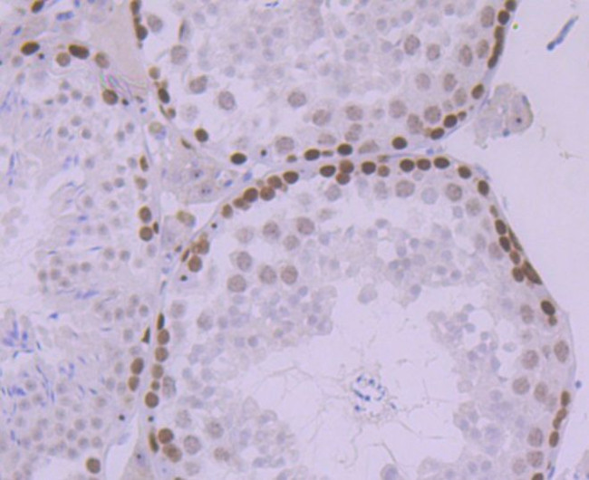 MCM5 Antibody in Immunohistochemistry (Paraffin) (IHC (P))