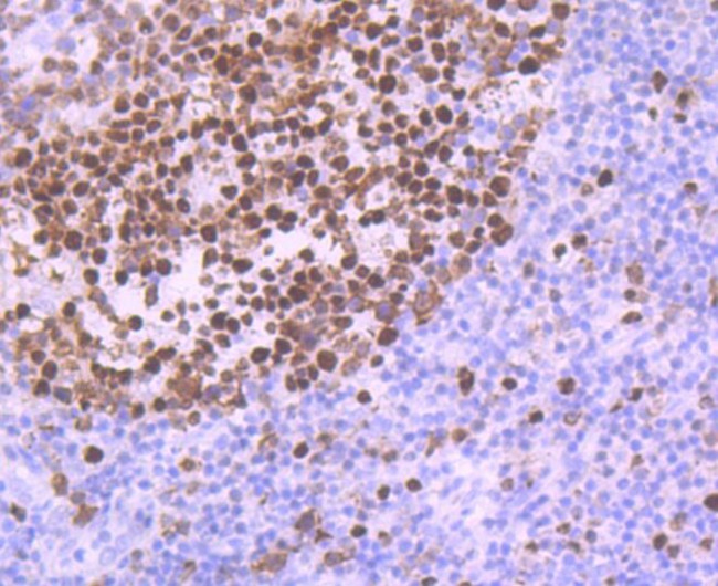 MCM5 Antibody in Immunohistochemistry (Paraffin) (IHC (P))