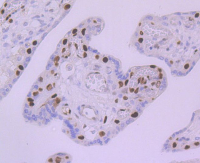 MCM5 Antibody in Immunohistochemistry (Paraffin) (IHC (P))