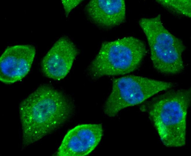 OGT Antibody in Immunocytochemistry (ICC/IF)